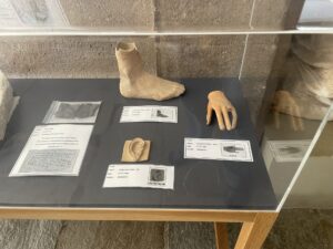Day 11- Asclepius Stone Body Part Offerings